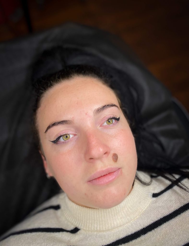 Obočie zákazníčky pred